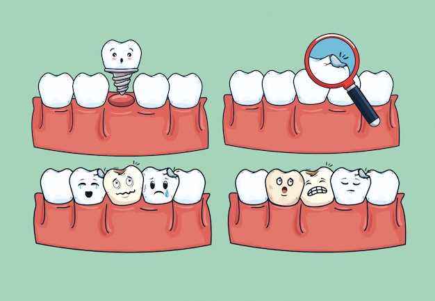 La importancia de los sueños en la interpretación de los dientes que se desmoronan