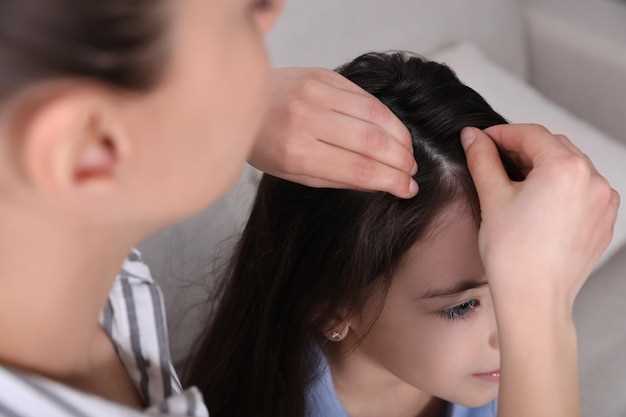 Sentir picazón en la propia cabeza causada por piojos en la cabeza de otra persona