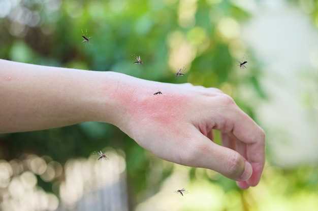 El significado de una picadura de avispa en el talón en sueños